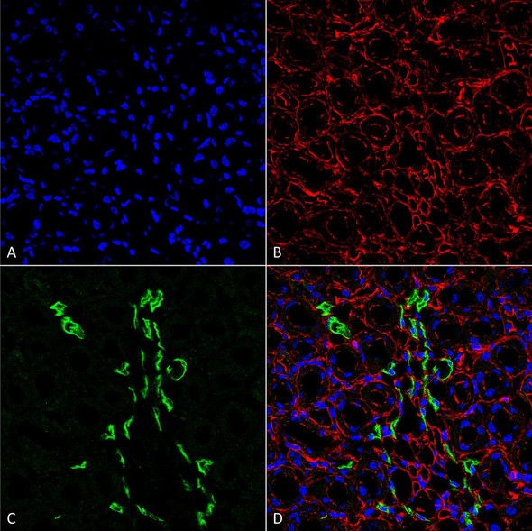 Immunohistochemistry analysis using Rabbit Anti-UT-A1 Polyclonal Antibody (STPA00050). Tissue: kidney tissue. Species: Rat. Fixation: Formalin Fixed Paraffin-Embedded. Primary Antibody: Rabbit Anti-UT-A1 Polyclonal Antibody (STPA00050) at 1:25 for 1 hour at RT. Secondary Antibody: Goat Anti-Rabbit IgG: Alexa Fluor 488. Counterstain: Actin-binding Phalloidin-Alexa Fluor 633; DAPI (blue) nuclear stain. Magnification: 63X.