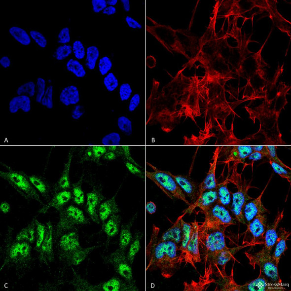 Immunocytochemistry/Immunofluorescence analysis using Rabbit Anti-Beclin 1 Polyclonal Antibody (STPA00057). Tissue: Neuroblastoma cell line (SK-N-BE). Species: Human. Fixation: 4% Formaldehyde for 15 min at RT. Primary Antibody: Rabbit Anti-Beclin 1 Polyclonal Antibody (STPA00057) at 1:100 for 60 min at RT. Secondary Antibody: Goat Anti-Rabbit ATTO 488 at 1:100 for 60 min at RT.