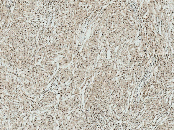 Immunohistochemistry analysis using Rabbit Anti-ATG10 Polyclonal Antibody (STPA00060). Tissue: Brain. Species: Human. Fixation: Formalin Fixed Paraffin-Embedded. Primary Antibody: Rabbit Anti-ATG10 Polyclonal Antibody (STPA00060) at 1:50 for 31 min at RT. Counterstain: Hematoxylin. Magnification: 10X.