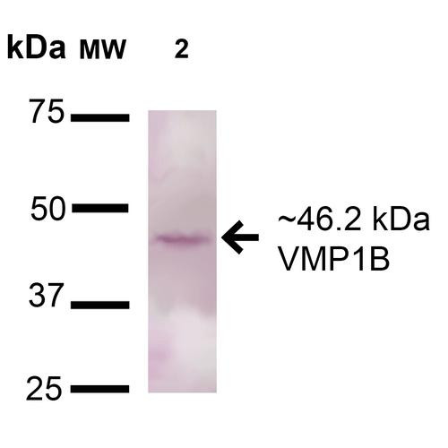 Western blot analysis of Human A549 showing detection of 46.2kDa VMP1 protein using Rabbit Anti-VMP1 Polyclonal Antibody (STPA00068). Lane 1: Molecular Weight Ladder (MW). Lane 2: A549 cell lysates. Load: 15 µg. Block: 5% Skim Milk in 1X TBST. Primary Antibody: Rabbit Anti-VMP1 Polyclonal Antibody (STPA00068) at 1:1000 for 16 hours at 4°C. Secondary Antibody: Goat-Anti-Rabbit IgG: HRP at 1:200 for 60 min at RT. Color Development: TMB.
