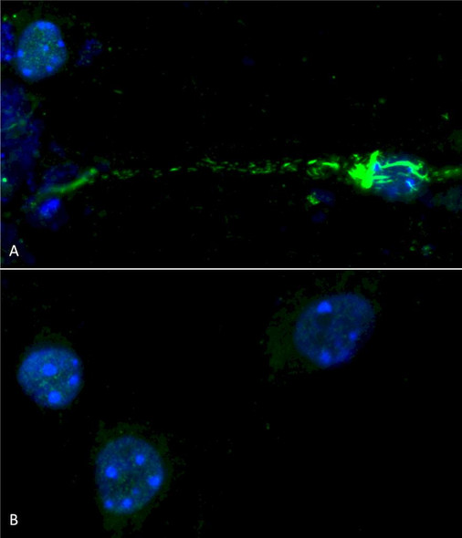 Immunocytochemistry/Immunofluorescence analysis using Rabbit Anti-Alpha Synuclein (pSer129) Polyclonal Antibody (STPA00078). Species: Mouse. Primary Antibody: Rabbit Anti-Alpha Synuclein (pSer129) Polyclonal Antibody (STPA00078). Phospho serine 129 antibody (STPA00078) was used to detect phosphorylated alpha synuclein in primary mouse hippocampal neurons treated with 100 nM sonicated mouse alpha synuclein PFFs (A).
