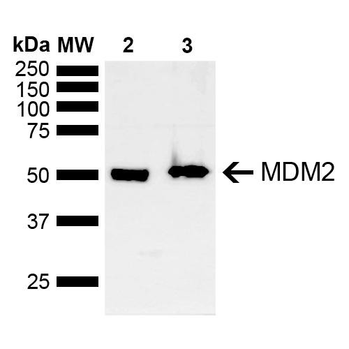Western blot analysis of Mouse, Rat Brain showing detection of ~40 kDa MDM2 protein using Rabbit Anti-MDM2 Polyclonal Antibody (STPA00083). Lane 1: Molecular Weight Ladder (MW). Lane 2: Mouse Brain. Lane 3: Rat Brain. Load: 15 µg. Block: 5% Skim Milk in 1X TBST. Primary Antibody: Rabbit Anti-MDM2 Polyclonal Antibody (STPA00083) at 1:1000 for 2 hours at RT. Secondary Antibody: Goat Anti-Rabbit IgG: HRP at 1:5000 for 1 hour at RT.