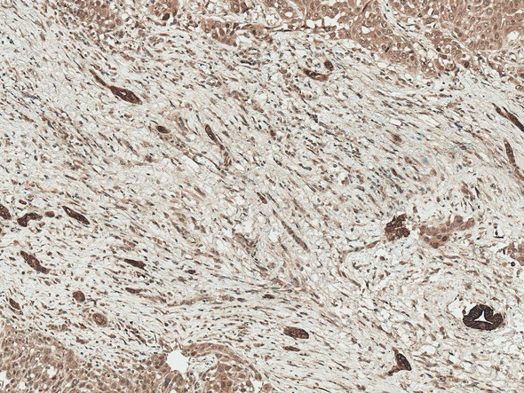 Immunohistochemistry analysis using Rabbit Anti-LRP1 Polyclonal Antibody (STPA00084). Tissue: Liver. Species: Human. Fixation: Formalin Fixed Paraffin-Embedded. Primary Antibody: Rabbit Anti-LRP1 Polyclonal Antibody (STPA00084) at 1:50 for 30 min at RT. Counterstain: Hematoxylin. Magnification: 10X. HRP-DAB Detection.