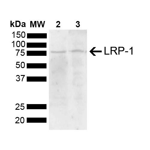 Western blot analysis of Mouse, Rat Brain showing detection of 504.6 kDa LRP-1 protein using Rabbit Anti-LRP-1 Polyclonal Antibody (STPA00084). Load: 15 µg. Block: 5% Skim Milk powder in TBST. Primary Antibody: Rabbit Anti-LRP-1 Polyclonal Antibody (STPA00084) at 1:1000 for 2 hours at RT with shaking. Secondary Antibody: Goat Anti-Rabbit IgG: HRP at 1:5000 for 1 hour at RT. Color Development: ECL solution for 5 min at RT.