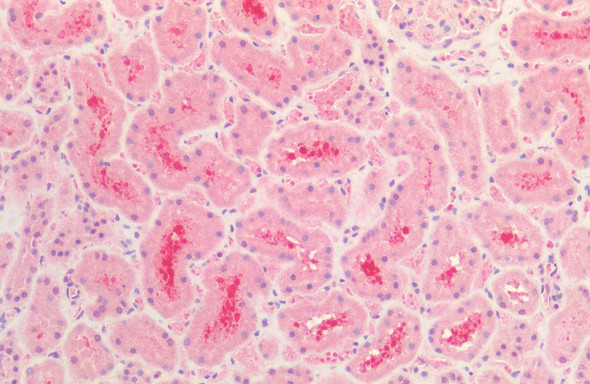 Immunohistochemistry analysis using Rabbit Anti-Tau Polyclonal Antibody (STPA00087). Tissue: Kidney. Species: Human. Fixation: Formalin fixed paraffin-embedded. Primary Antibody: Rabbit Anti-Tau Polyclonal Antibody (STPA00087).
