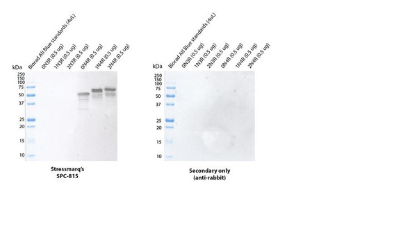 Western blot analysis using STPA00092 on purified Human Recombinant Tau isoforms comparing detection of the targets. Protein was transferred to nitrocellulose, blocked with 5% BSA, incubated with the primary antibody at 1:1000 dilution, followed by incubation in the secondary antibody at 1:4000 dilution. Secondary control is goat-anti-rabbit:HRP. Exposed 5 seconds.