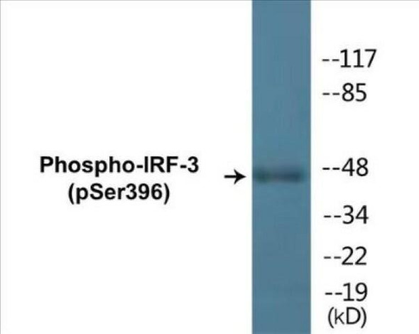 IRF-3 (Phospho-Ser396) Colorimetric Cell-Based ELISA Kit