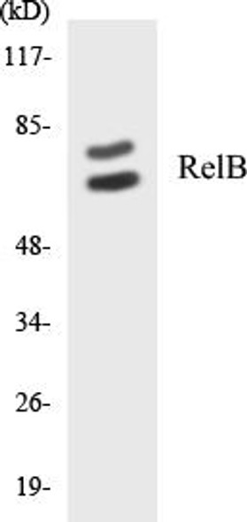 RelB Colorimetric Cell-Based ELISA Kit