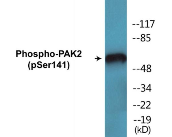 PAK2 (Phospho-Ser141) Colorimetric Cell-Based ELISA Kit