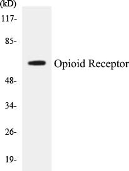 Opioid Receptor Colorimetric Cell-Based ELISA Kit