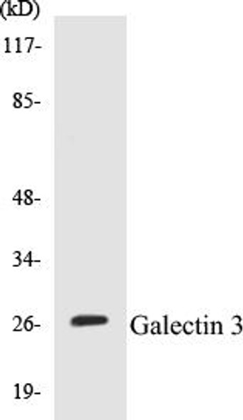 Galectin 3 Colorimetric Cell-Based ELISA Kit