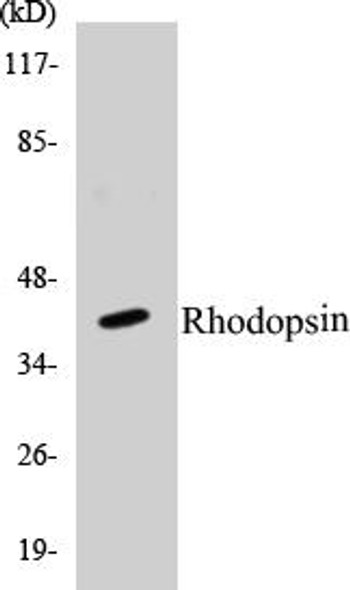 Rhodopsin Colorimetric Cell-Based ELISA Kit
