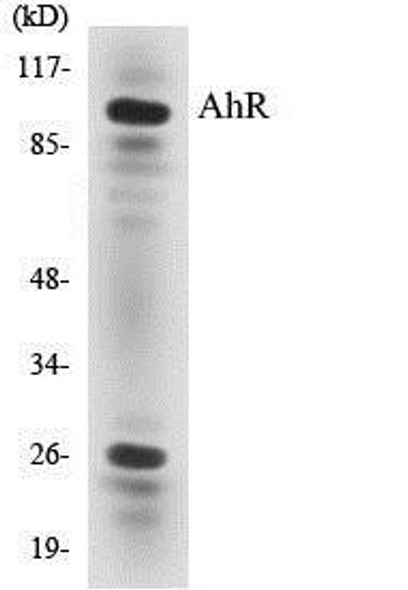 AhR Colorimetric Cell-Based ELISA Kit