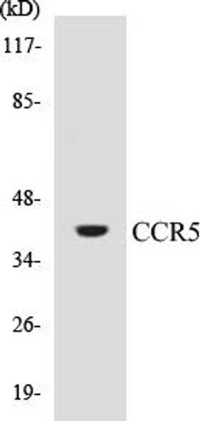 CCR5 Colorimetric Cell-Based ELISA Kit