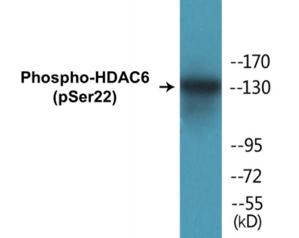HDAC6 (Phospho-Ser22) Colorimetric Cell-Based ELISA Kit