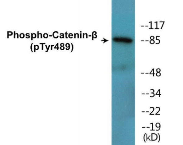 Catenin-beta (Phospho-Tyr489) Colorimetric Cell-Based ELISA Kit