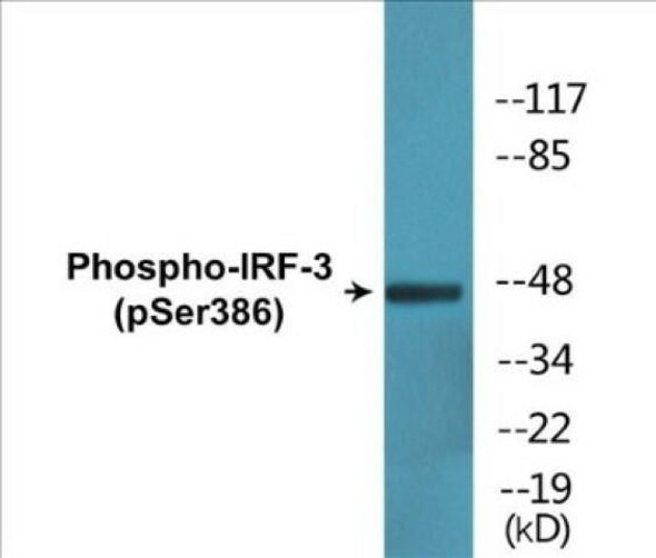 IRF-3 (Phospho-Ser386) Colorimetric Cell-Based ELISA Kit