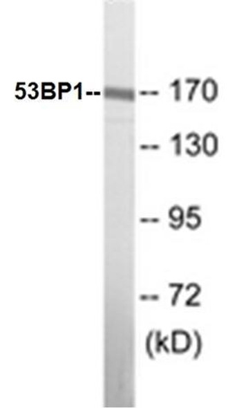 53BP1 Colorimetric Cell-Based ELISA Kit