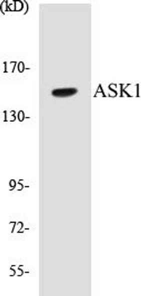 ASK1 Colorimetric Cell-Based ELISA Kit