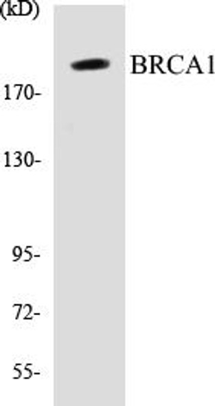 BRCA1 Colorimetric Cell-Based ELISA Kit