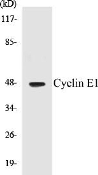 Cyclin E1 Colorimetric Cell-Based ELISA Kit