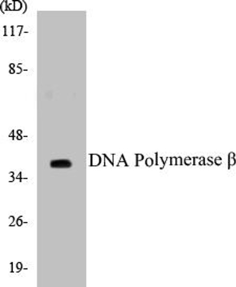 DNA Polymerase beta Colorimetric Cell-Based ELISA Kit