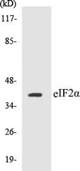 eIF2alpha Colorimetric Cell-Based ELISA Kit