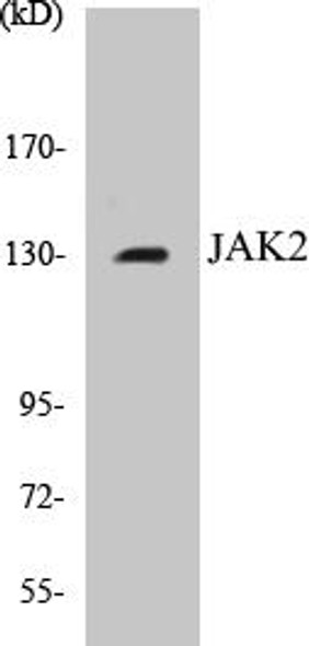 JAK2 Colorimetric Cell-Based ELISA Kit