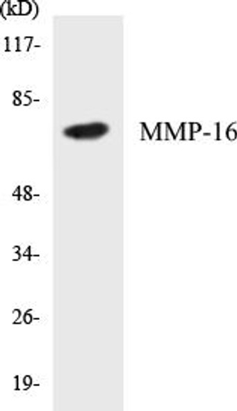 MMP-16 Colorimetric Cell-Based ELISA Kit