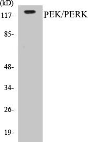 PEK/PERK Colorimetric Cell-Based ELISA Kit