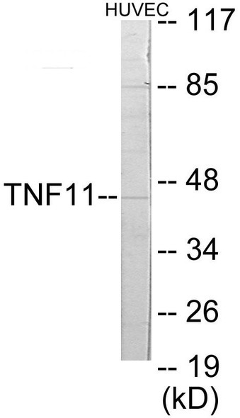TNFSF11 Colorimetric Cell-Based ELISA