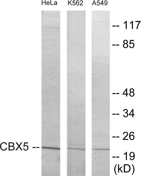 CBX5 Colorimetric Cell-Based ELISA