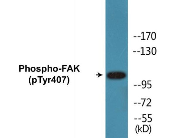 FAK (Phospho-Tyr407) Colorimetric Cell-Based ELISA Kit