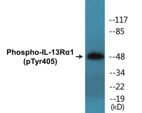 IL-13Ralpha1 (Phospho-Tyr405) Colorimetric Cell-Based ELISA Kit