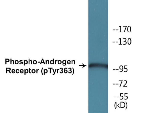 Androgen Receptor (Phospho-Tyr363) Colorimetric Cell-Based ELISA Kit