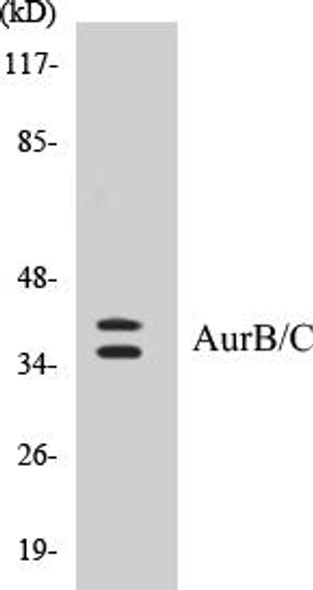 AurB/C Colorimetric Cell-Based ELISA Kit