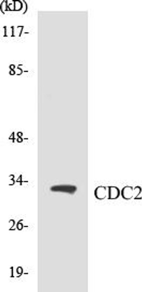 CDC2 Colorimetric Cell-Based ELISA Kit