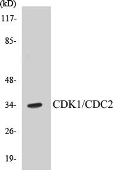 CDK1/CDC2 Colorimetric Cell-Based ELISA Kit