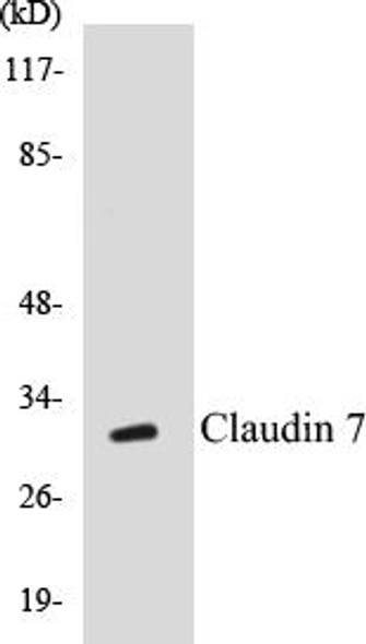 Claudin 7 Colorimetric Cell-Based ELISA Kit
