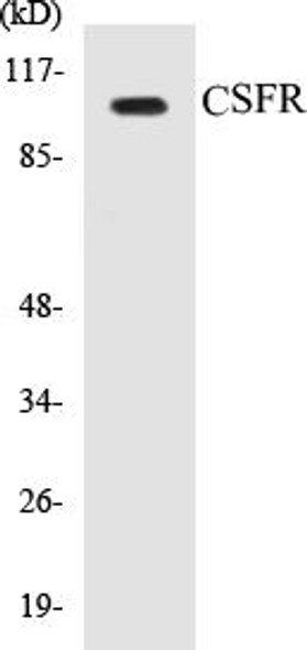 CSFR Colorimetric Cell-Based ELISA Kit