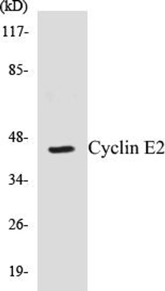 Cyclin E2 Colorimetric Cell-Based ELISA Kit