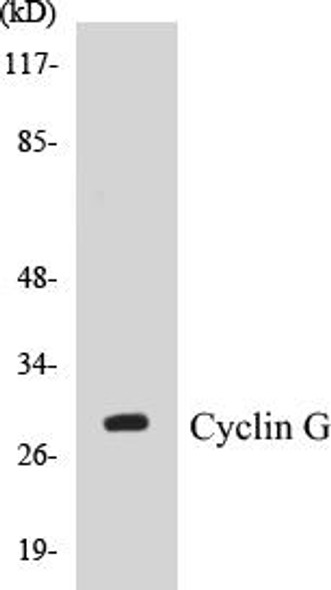 Cyclin G Colorimetric Cell-Based ELISA Kit