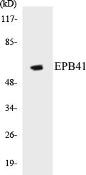 EPB41 Colorimetric Cell-Based ELISA Kit