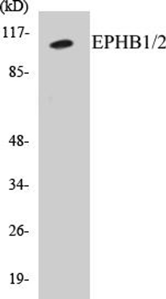 EPHB1/2 Colorimetric Cell-Based ELISA Kit