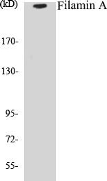 Filamin A Colorimetric Cell-Based ELISA Kit