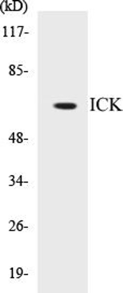 ICK Colorimetric Cell-Based ELISA Kit