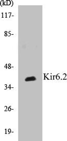 Kir6.2 Colorimetric Cell-Based ELISA Kit