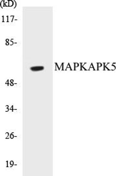 MAPKAPK5 Colorimetric Cell-Based ELISA Kit