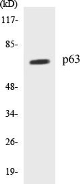 p63 Colorimetric Cell-Based ELISA Kit