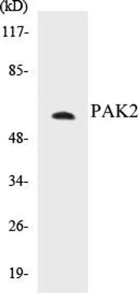 PAK2 Colorimetric Cell-Based ELISA Kit